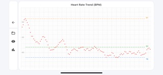 ECG Suite screenshot