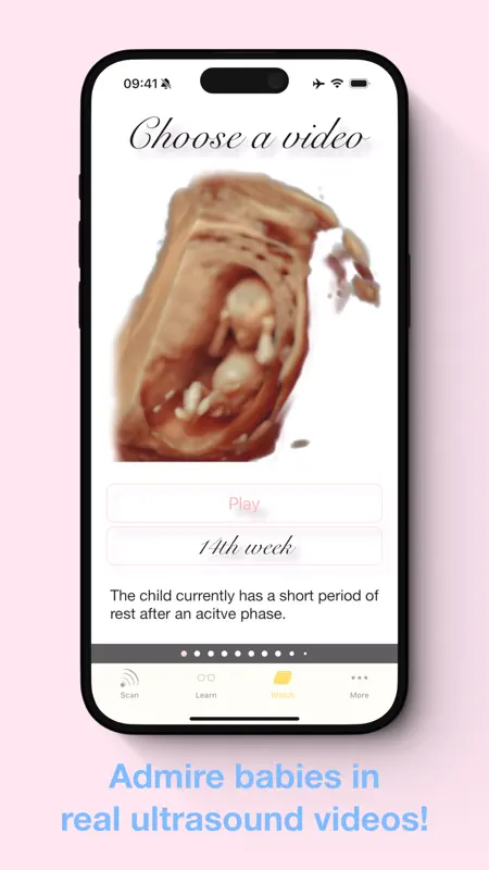 ScanBaby learn baby ultrasound screenshot 8 of 8