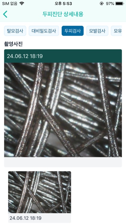 ScalpMate screenshot-3