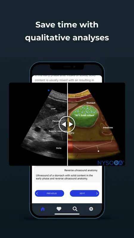 Point of Care Ultrasound screenshot 5 of 8