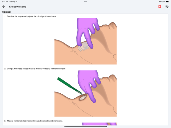 palmEM AI: EM Quick Reference iPad screenshot 7 - Medical app