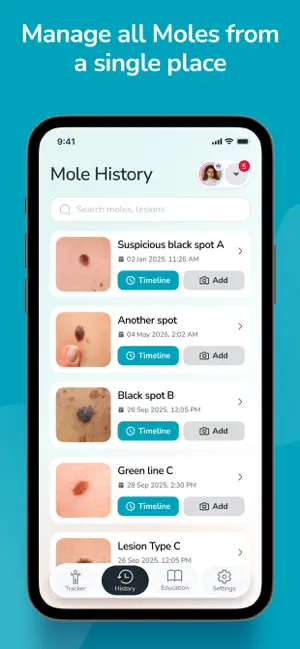 Family Mole Tracker screenshot 2