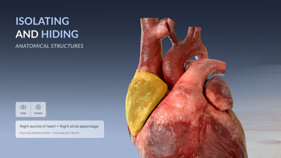 VOKA 3D Anatomy & Pathology Screenshot