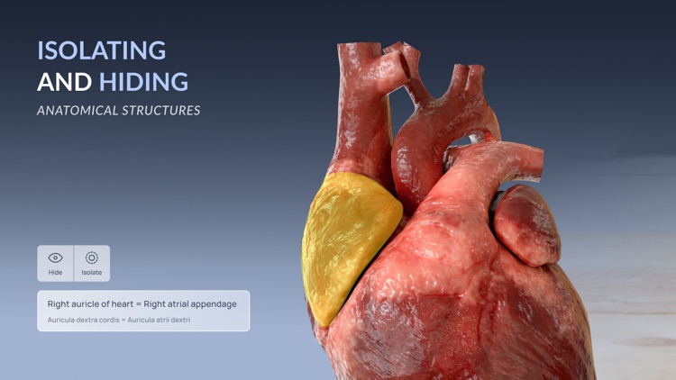 VOKA 3D Anatomy & Pathology screenshot-3