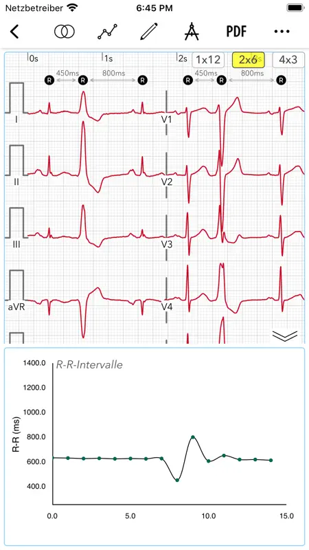 EKG Pro für Ärzte screenshot 6 of 10