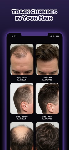 HairCode: AI Hair Loss Scanner screenshot