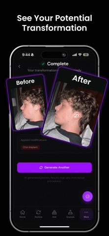 JawMax screenshot