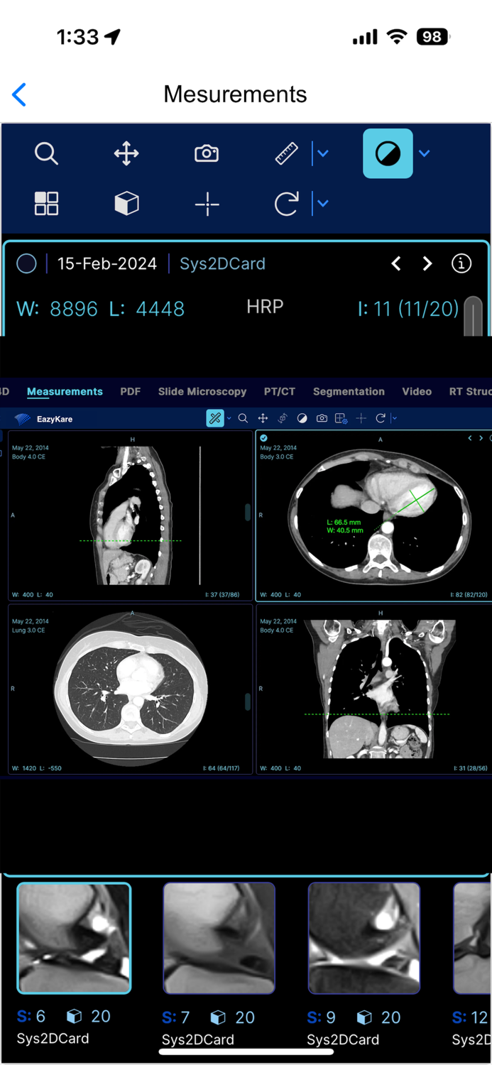 EazyGo  Easy PACS  DICOM