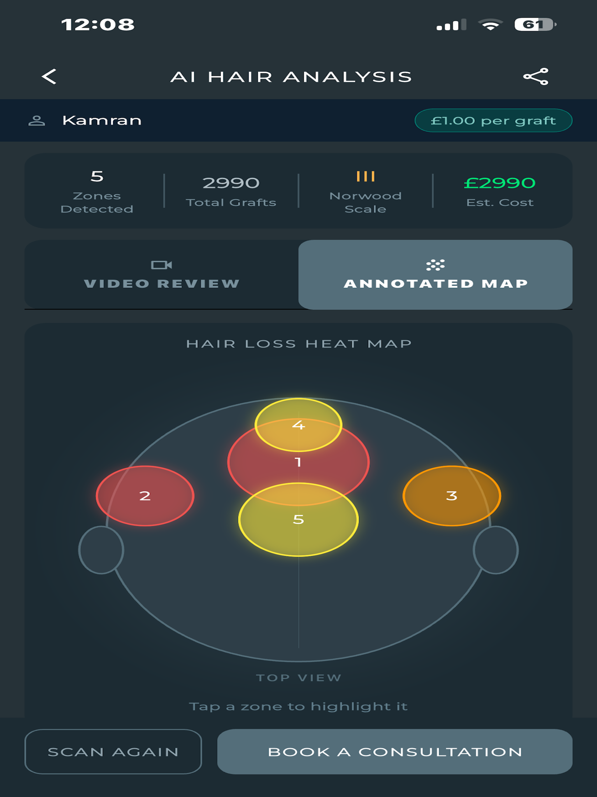 SurgiTracker: Hair Clinic AI screenshot 13