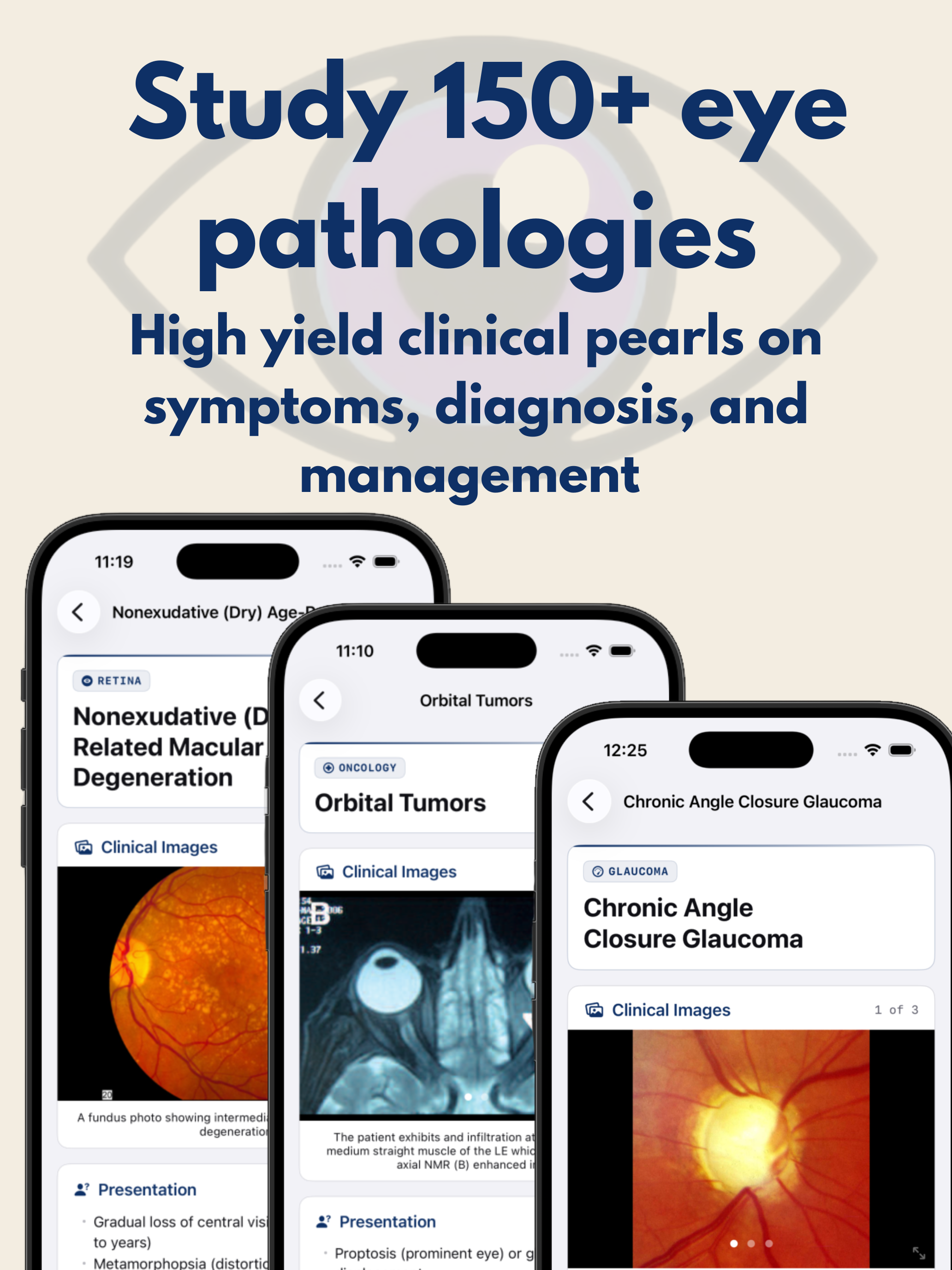 OcuLearning - Ophthalmology screenshot 7