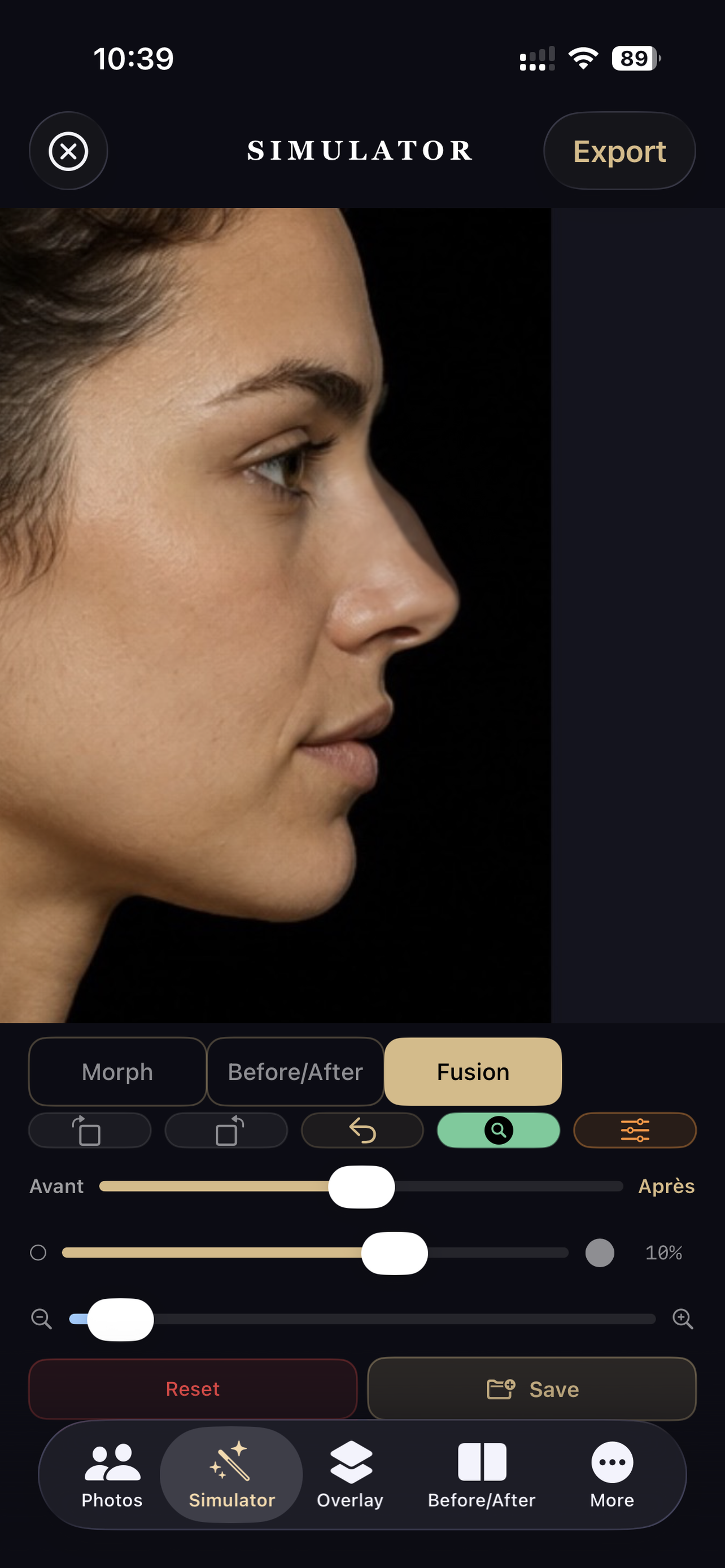RhinoplastySimulator