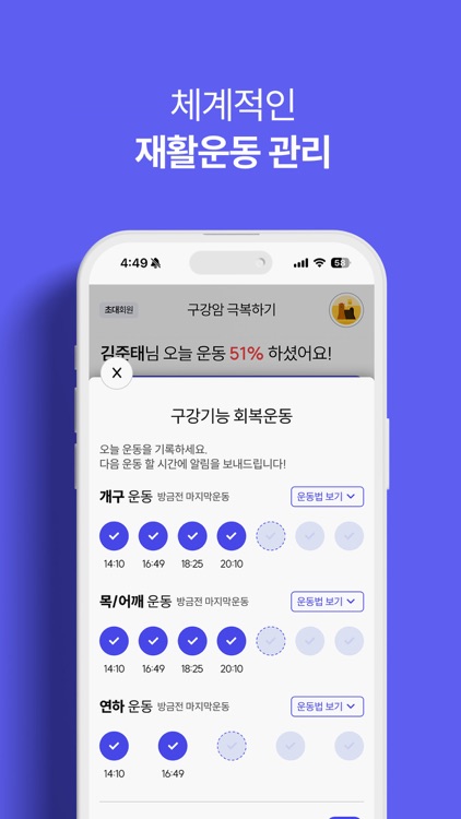 구강암 극복하기