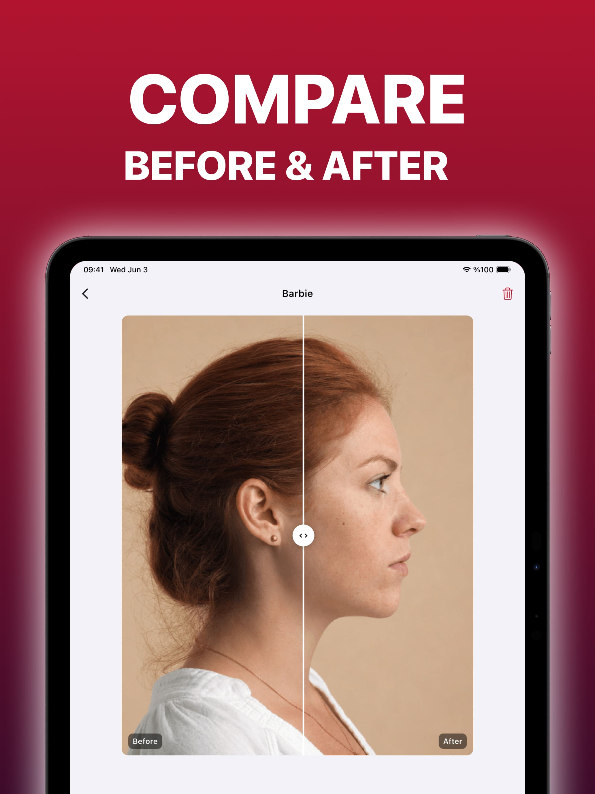 Nose Job Simulator: NoseChic screenshot 5