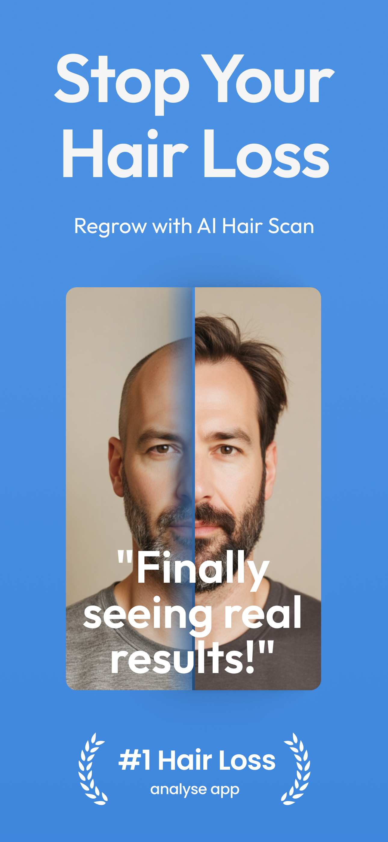 Regrow Hair: AI Hair Scan