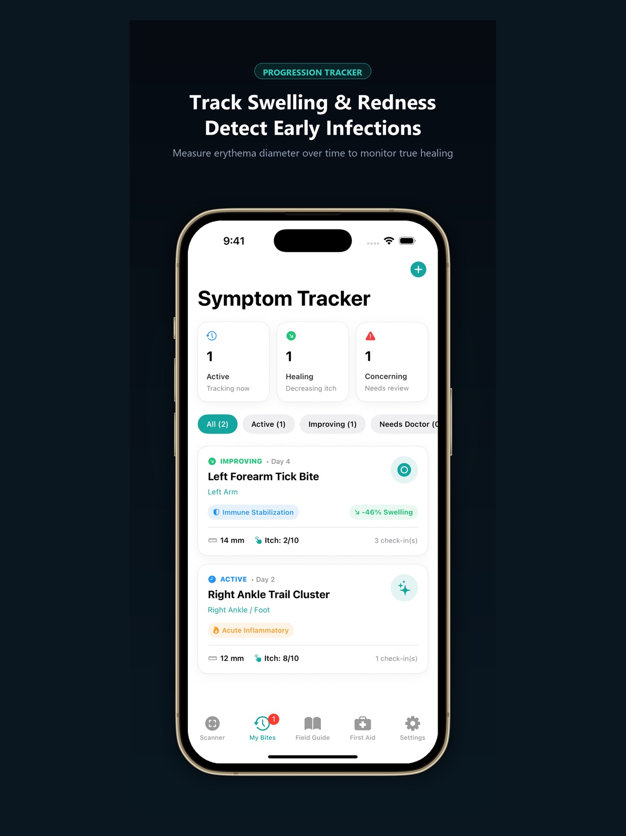 Screenshot 8 of BiteCheck: Bug Bite Identifier