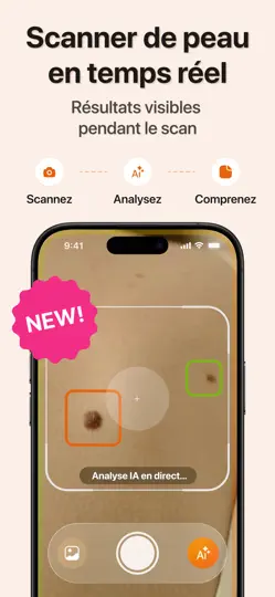 Capture d'écran de Scanner IA Santé De Peau sur iPhone 2