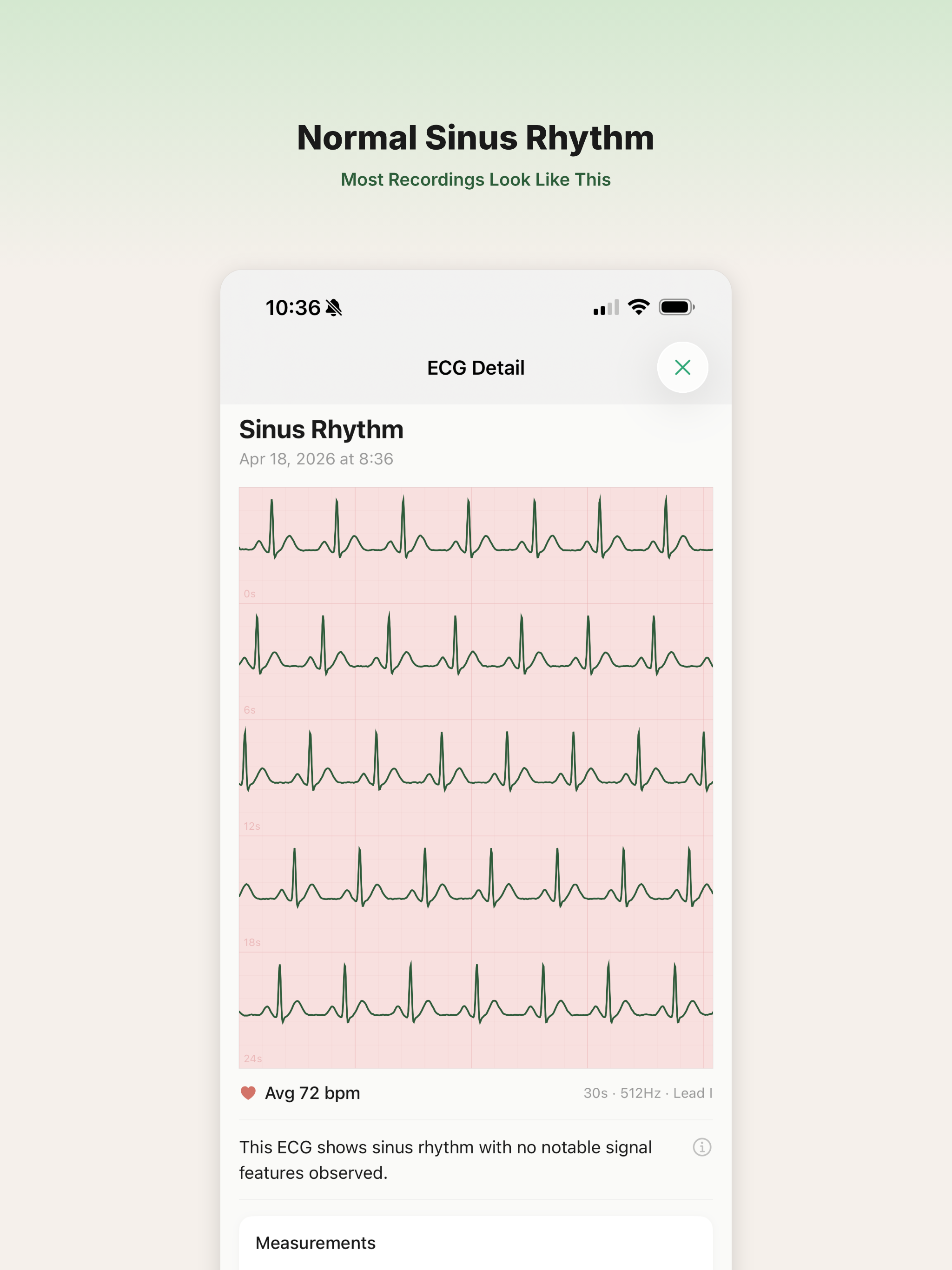 CardioWatch Pro