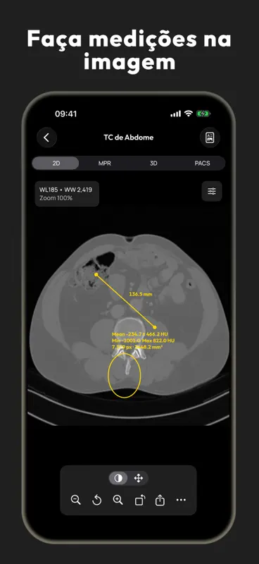 Visor DICOM - MesDICOM screenshot 5 of 8
