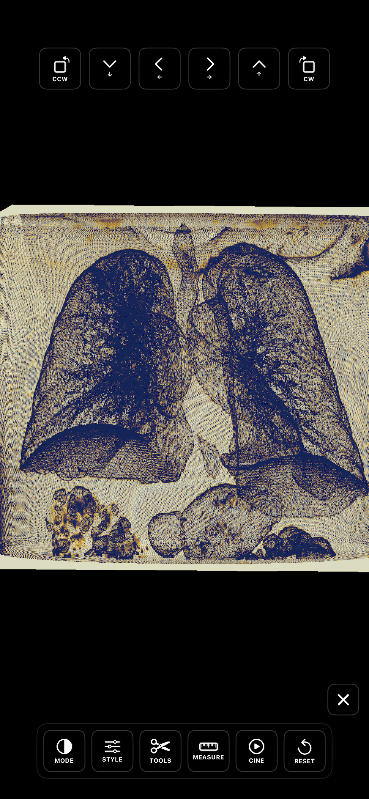 ScalarMetrics DICOM Viewer screenshot 8