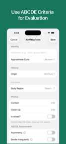 Mole Checker & Monitor screenshot