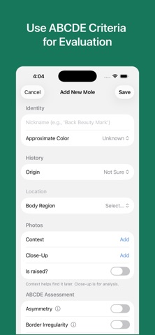 Mole Checker & Monitor iPhone screenshot