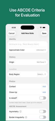 Mole Checker & Monitor screenshot 2