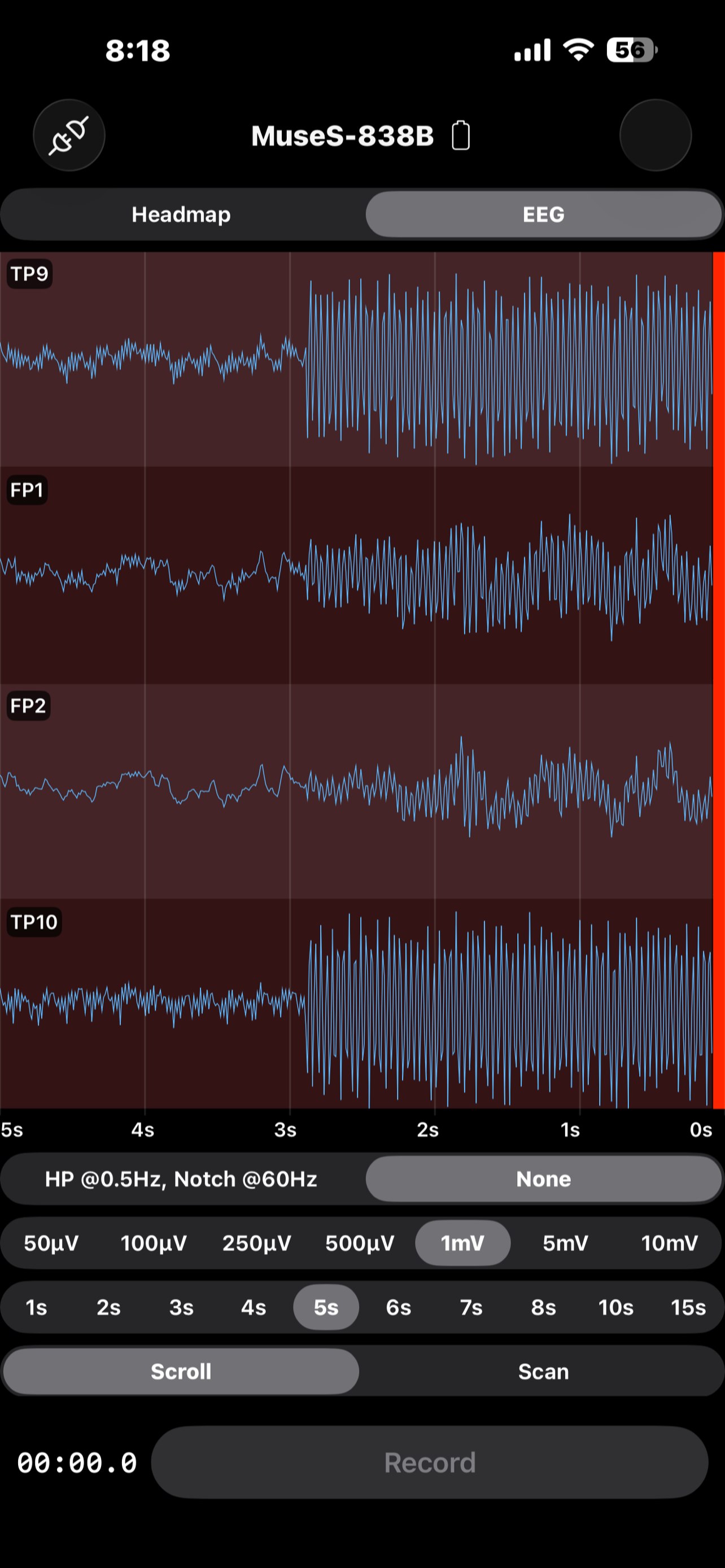 EEG Recorder