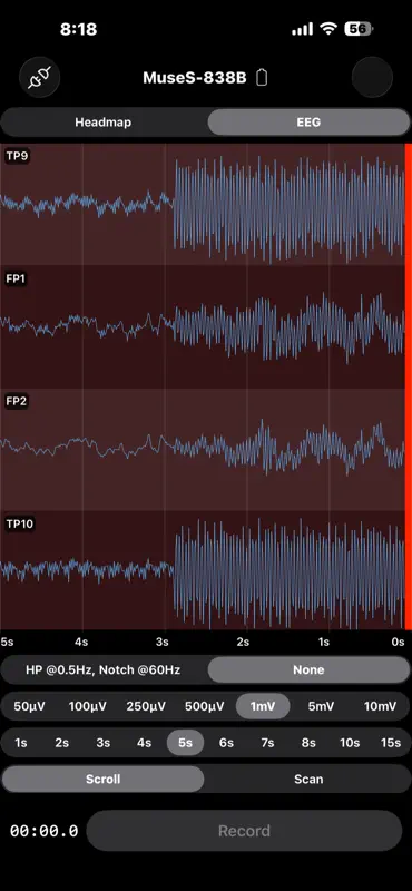 EEG Recorder screenshot 6 of 7