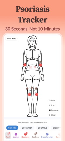 Psoriasis Tracker Screenshot 1 of 10
