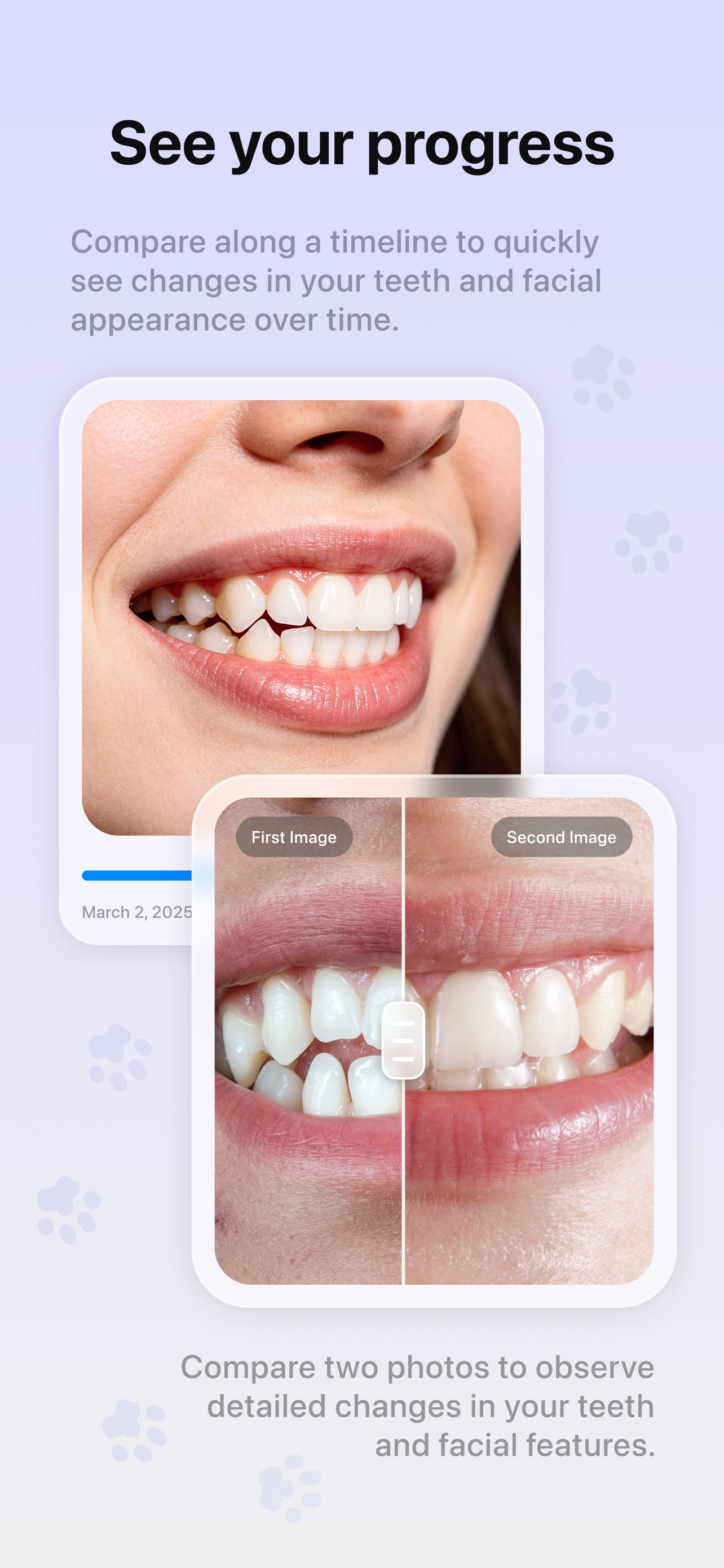 BraceTime: Aligner Tracker screenshot 4