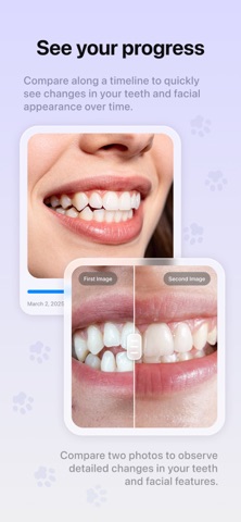 BraceTime: Aligner Tracker Screenshot 4 of 9