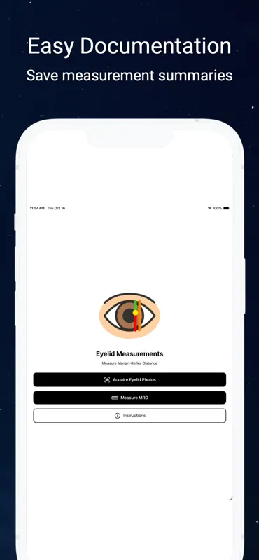 Eyelid, Ptosis, Blepharoplasty screenshot 3 of 3