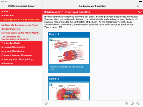 Screenshot #4 pour STS Cardiothoracic Surgery