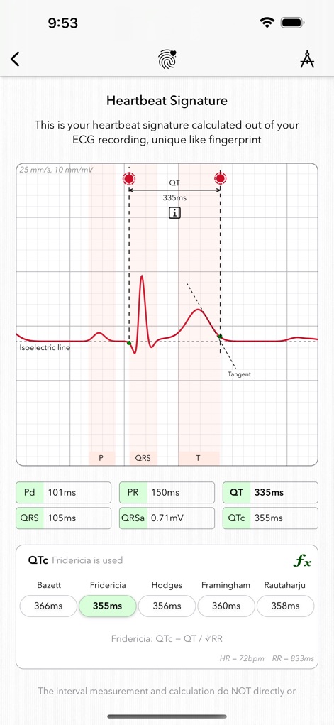 ECG+ | Your Watch ECG Reader - L'outil permet une analyse détaillée de la morphologie de l'ECG avec l'identification des ondes P, QRS et T, et propose des mesures précises des intervalles, incluant plusieurs calculs pour le QTc.