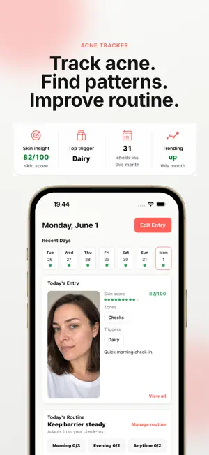 Claro: Acne Tracker screenshot 1