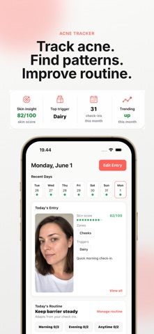 Claro: Acne Tracker iPhone screenshot