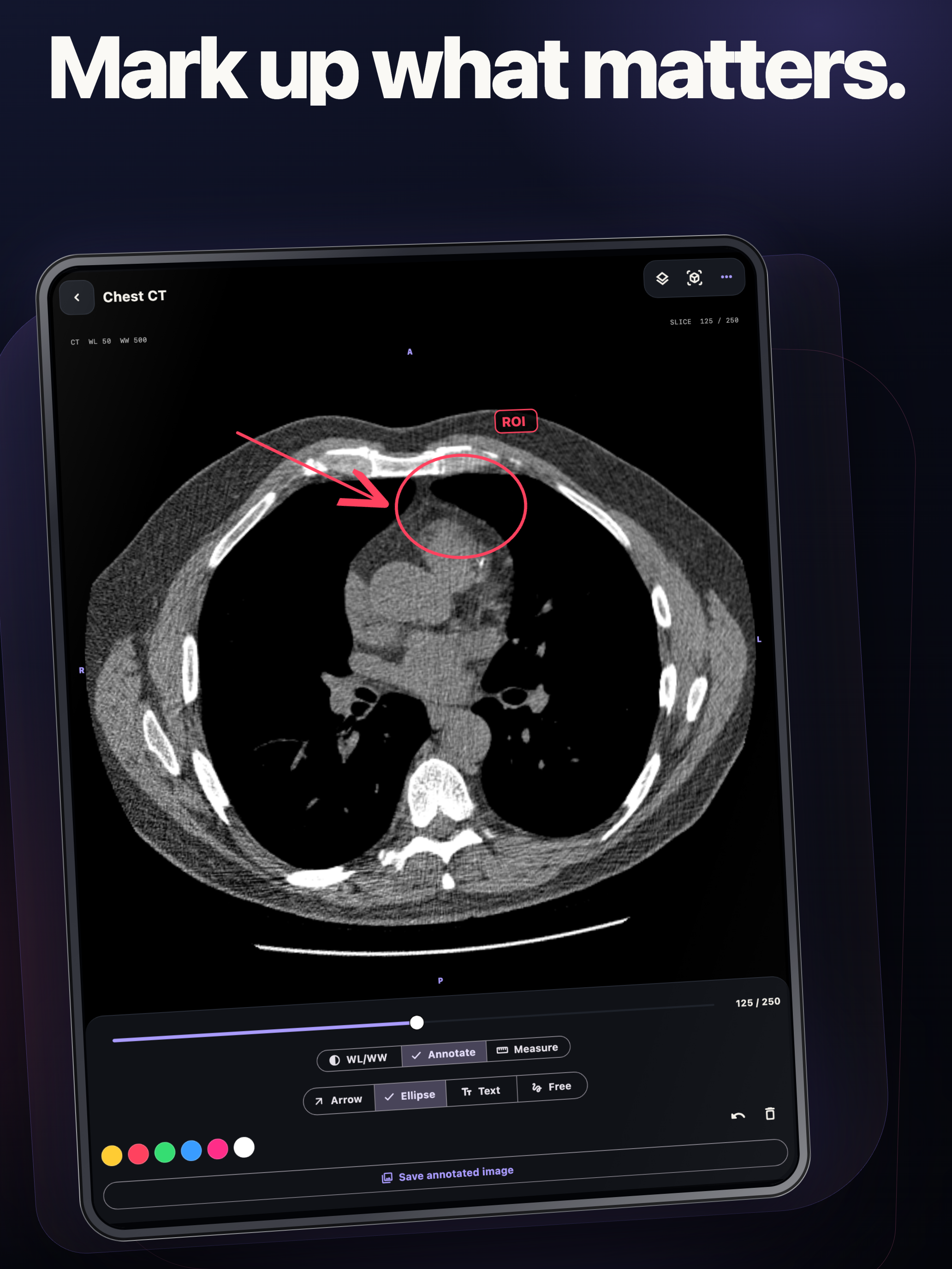 DICOM Studio: MRI CT Viewer screenshot 11
