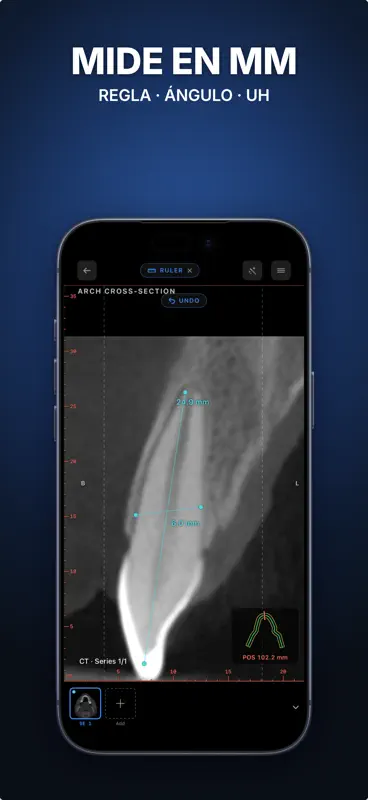 Ossidex: Visor DICOM, TAC, RM screenshot 4 of 6