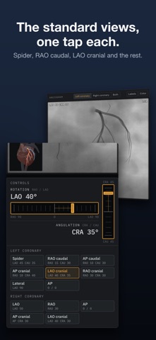 AngioView screenshot 3