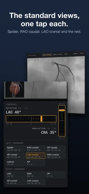 AngioView screenshot 3 of 5