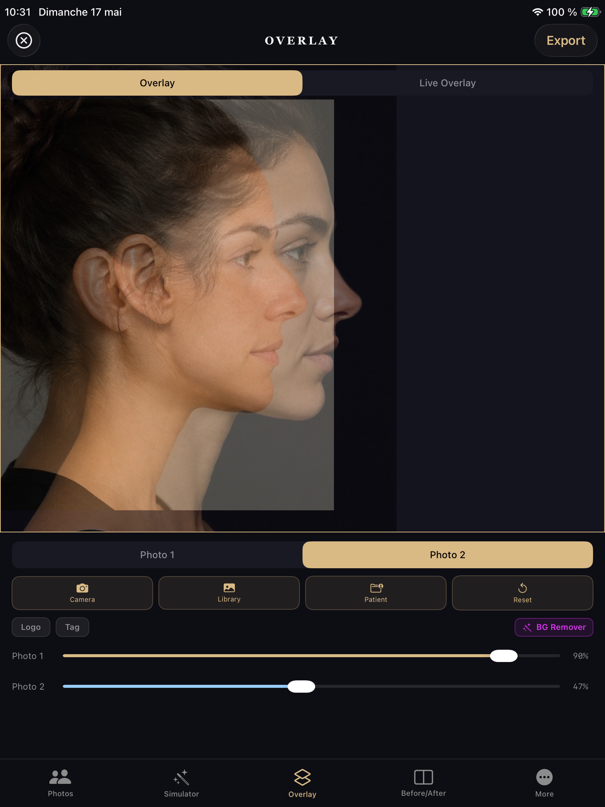 Rhinoplasty Simulator Pro