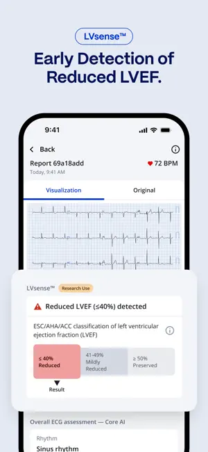 PMcardio for Individuals screenshot 3
