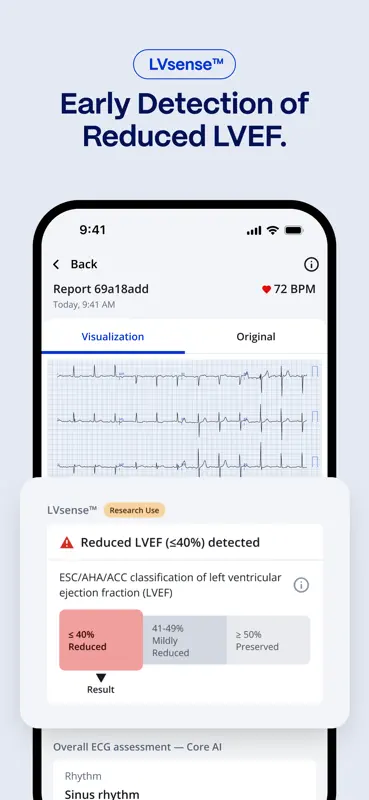 PMcardio for Individuals screenshot 3 of 4