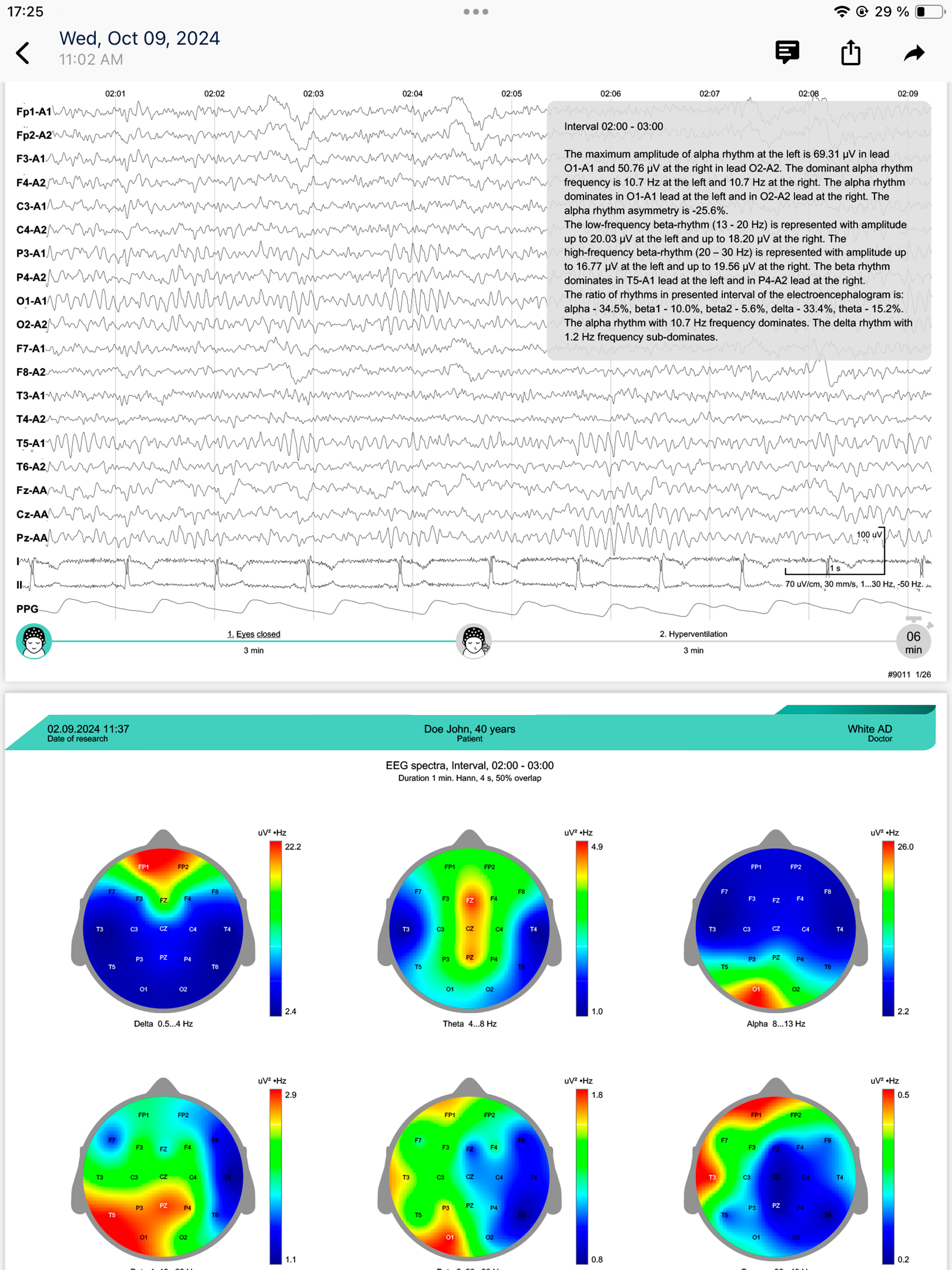 NEUROvisor