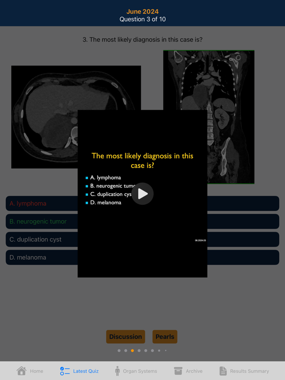CTisus iQuiz 25 iPad screenshot 4 - Medical app