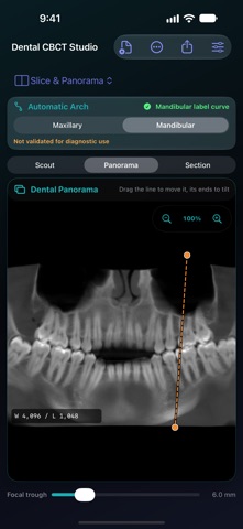 Dental CBCT Studio Screenshot 3 of 5