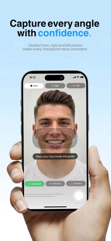 BraceLog - Your Braces Journey Screenshot 2 of 8