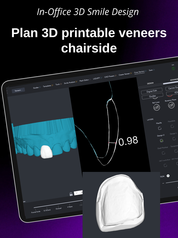 SmileFy TNG iPad screenshot 7 - Medical app