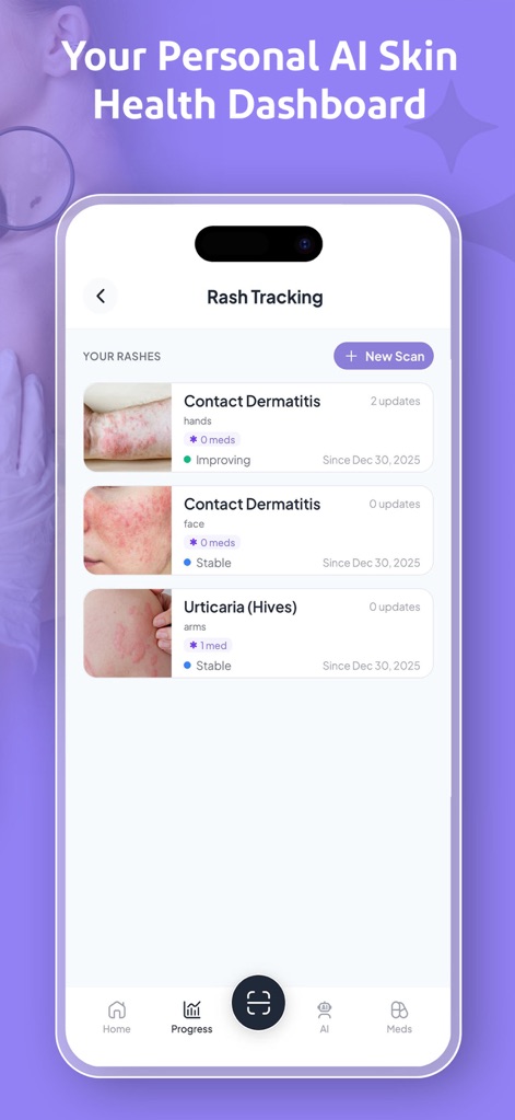 Rash Scan: AI Dermatologist - 의료 앱 | MWM