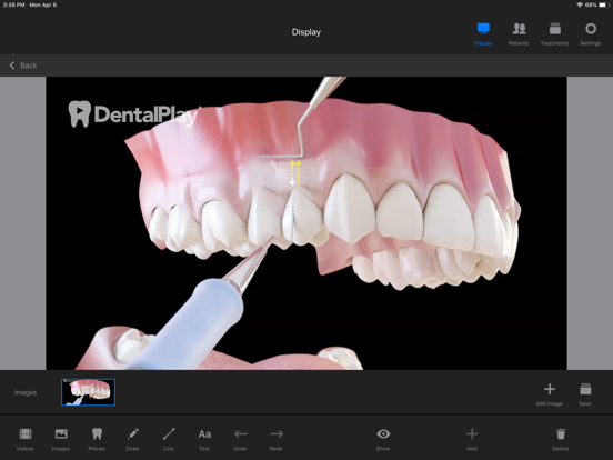 Screenshot #6 pour Dentool